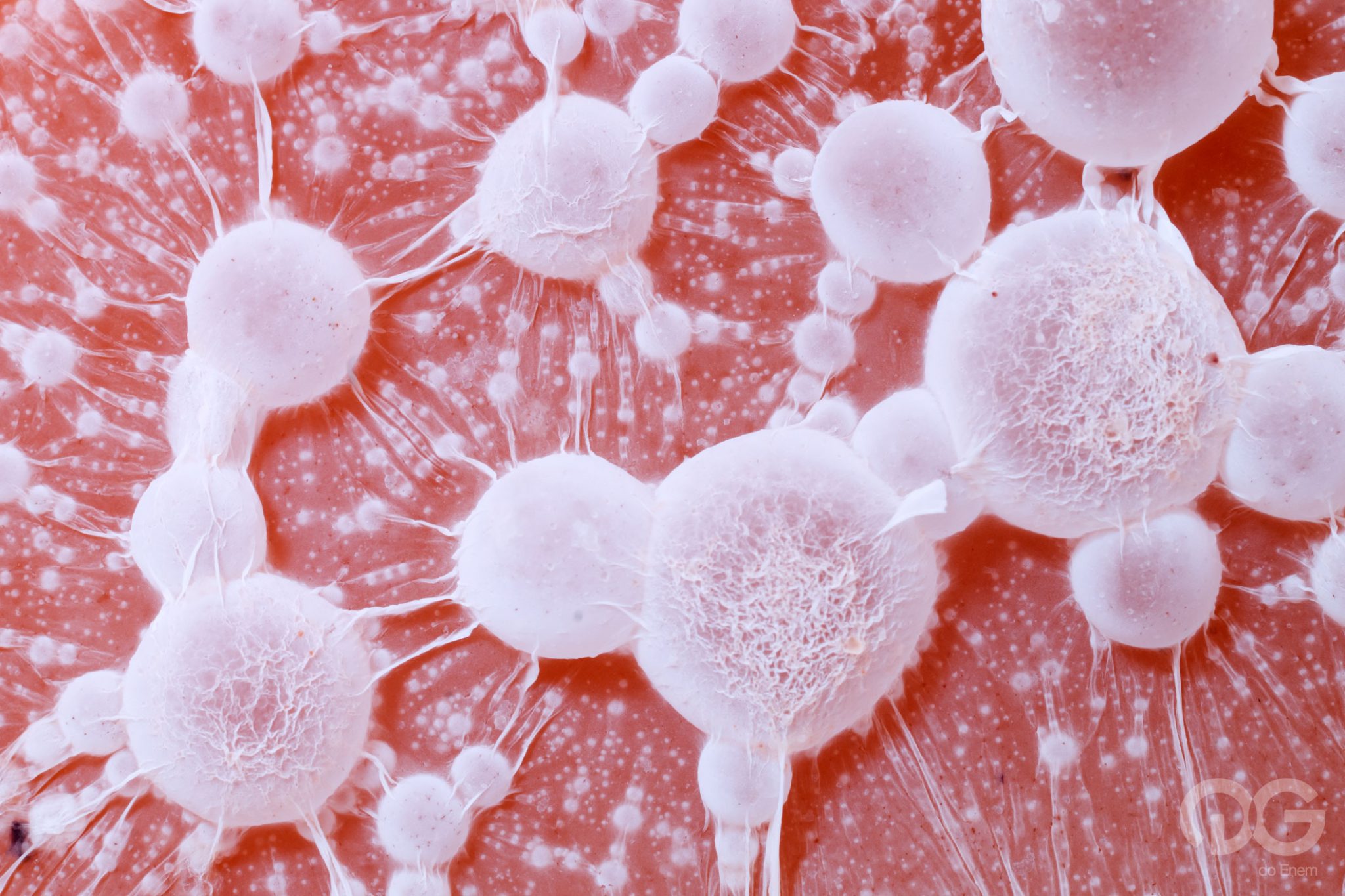 tumor